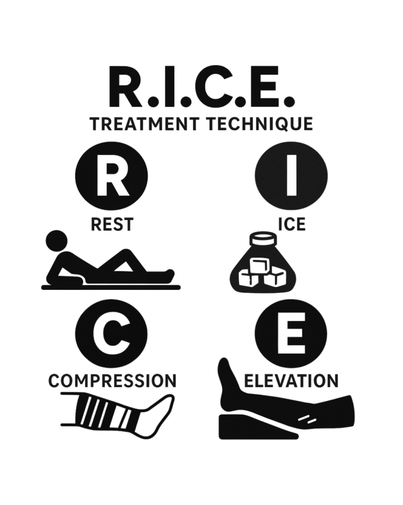 r.i.c.e. technique