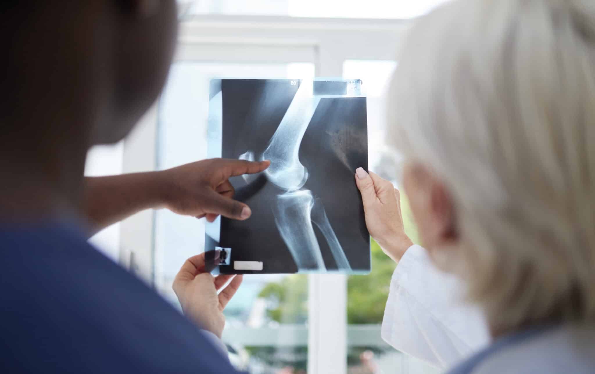 so many fractures in one bone.