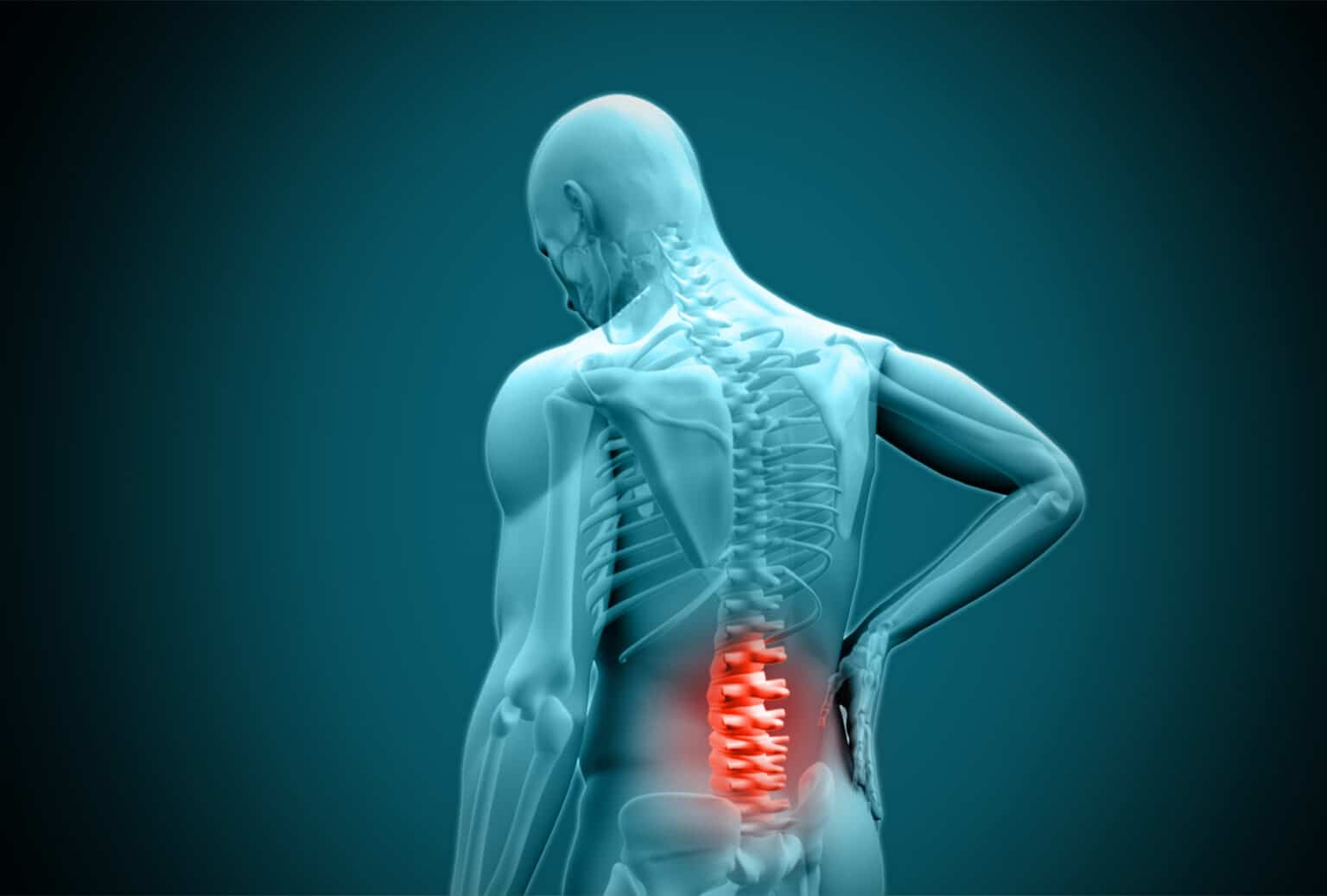 Slipped Disc (Herniated Disc): Causes, Symptoms & Treatment - OrthoNJ