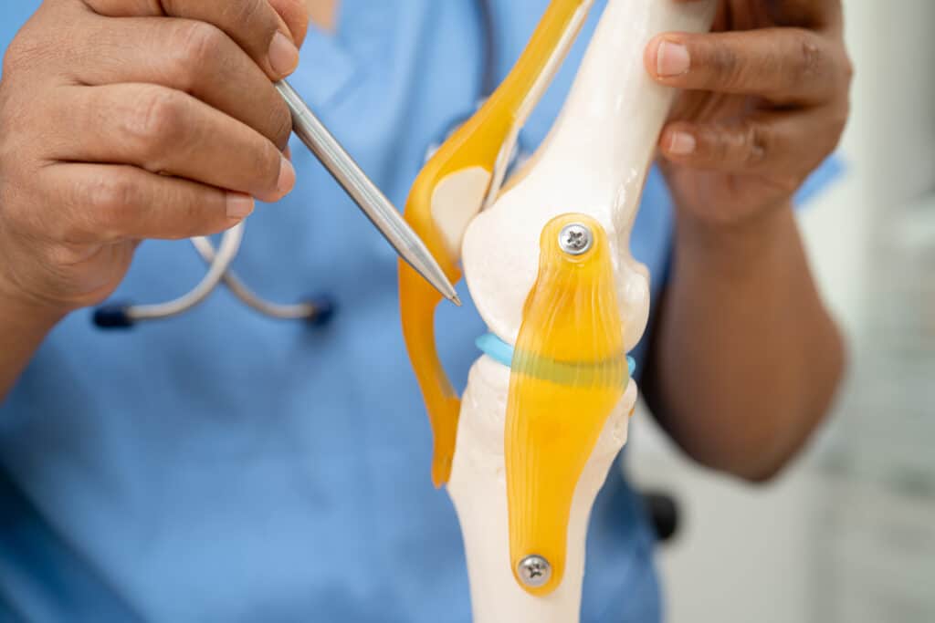 osteoarthritis of the knee, doctor holding human knee joint orth