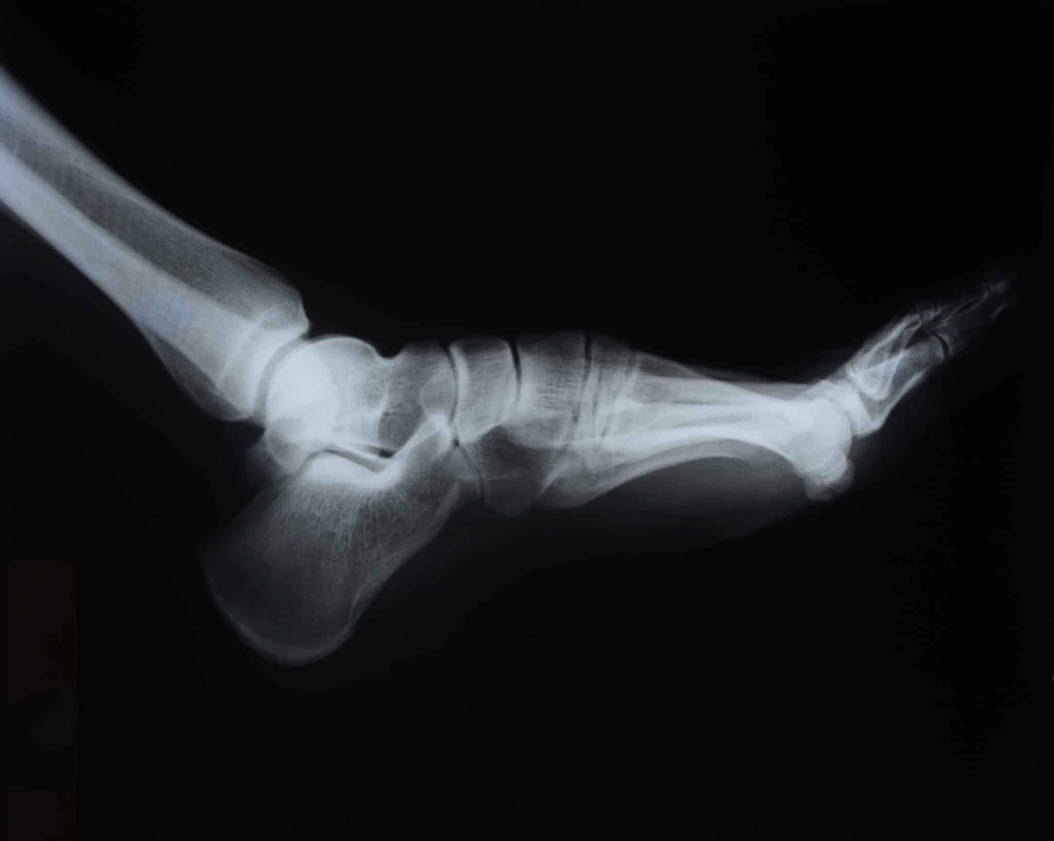 foot x ray detail