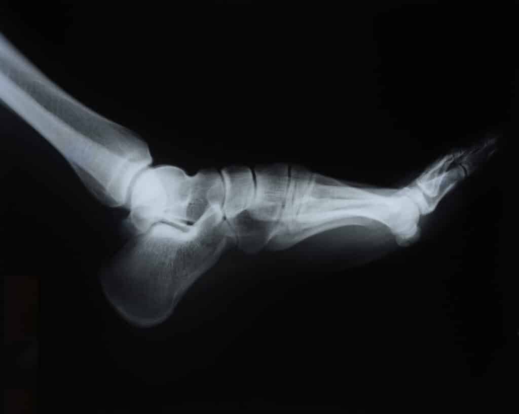 foot x ray detail